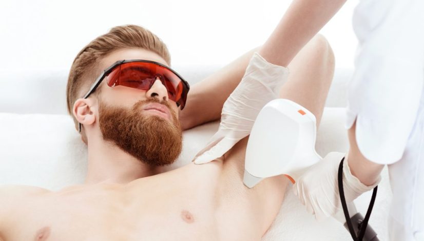harga laser hair removal pria