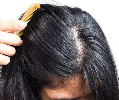 a-womans-scalp-min-1067x1067
