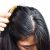 a-womans-scalp-min-1067x1067