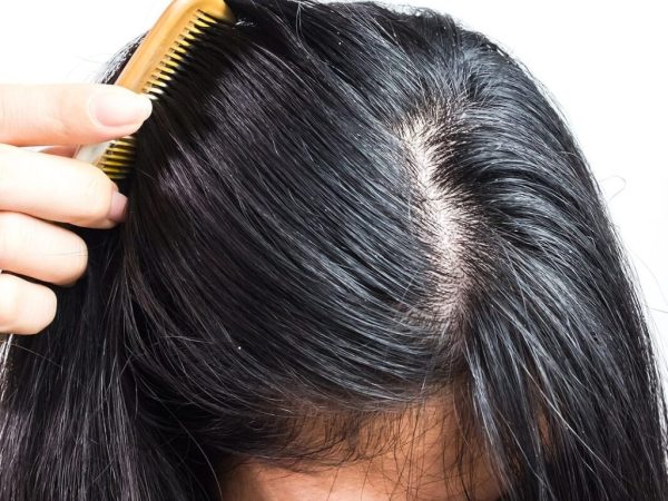 a-womans-scalp-min-1067x1067