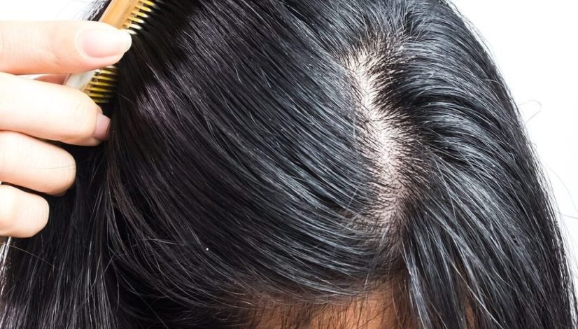 a-womans-scalp-min-1067x1067