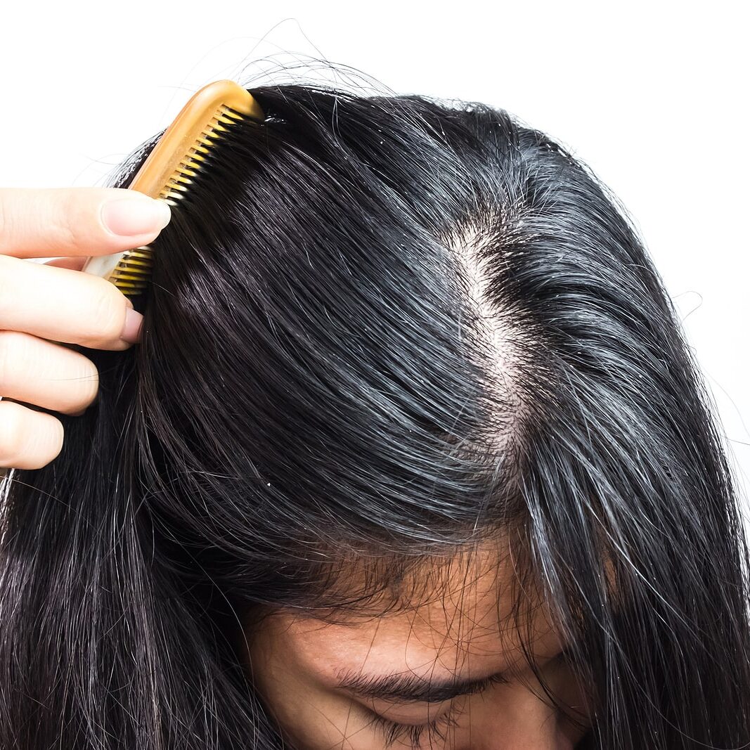 a-womans-scalp-min-1067x1067