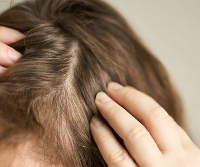 treatment rambut tipis