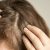 treatment rambut tipis