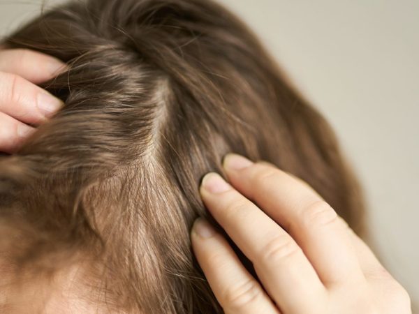 treatment rambut tipis
