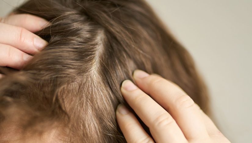 treatment rambut tipis