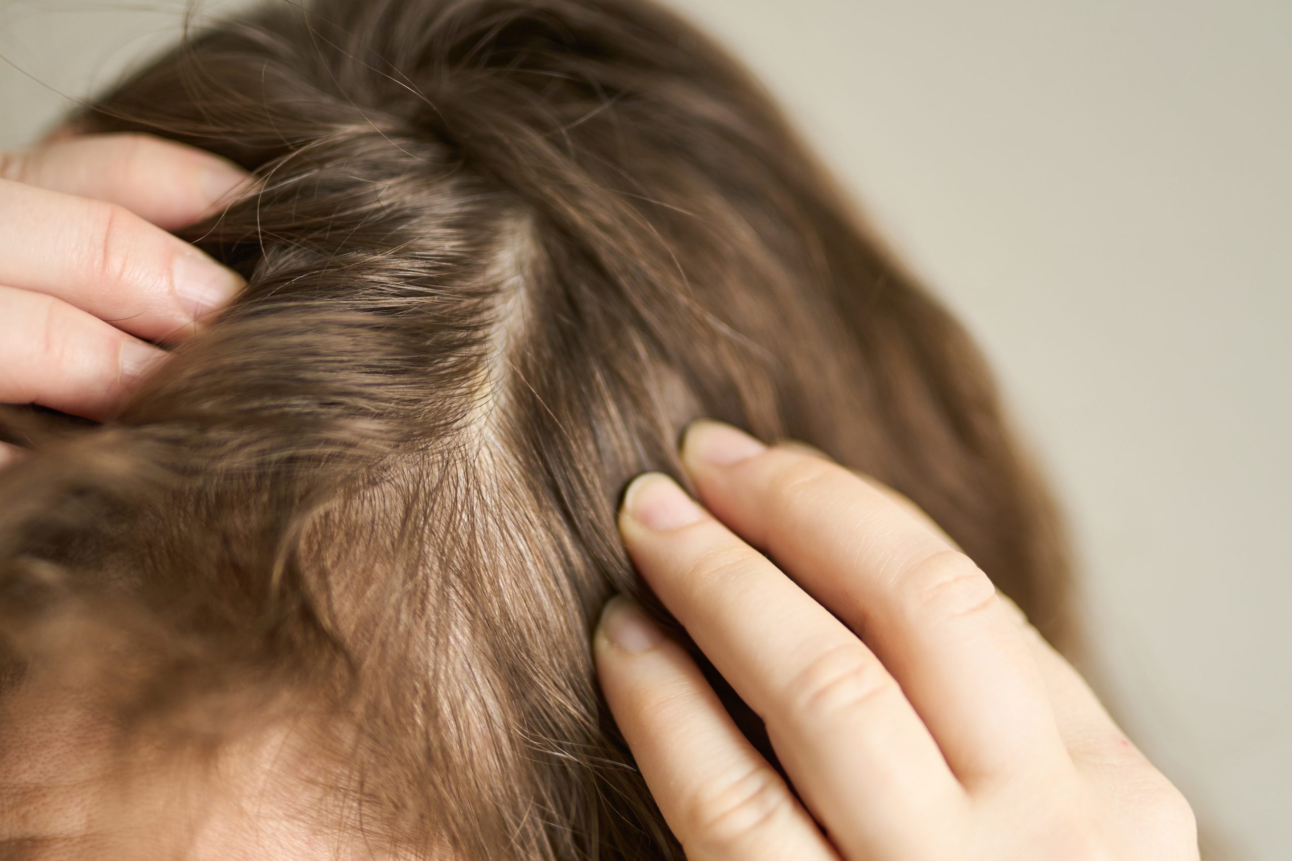 treatment rambut tipis