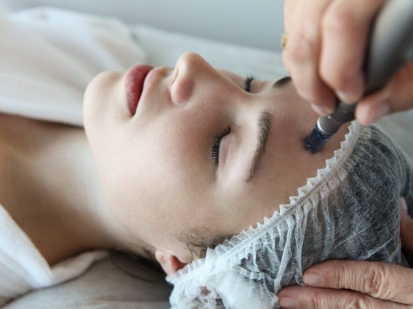 ColdLift facial treatment