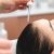 scalp treatment