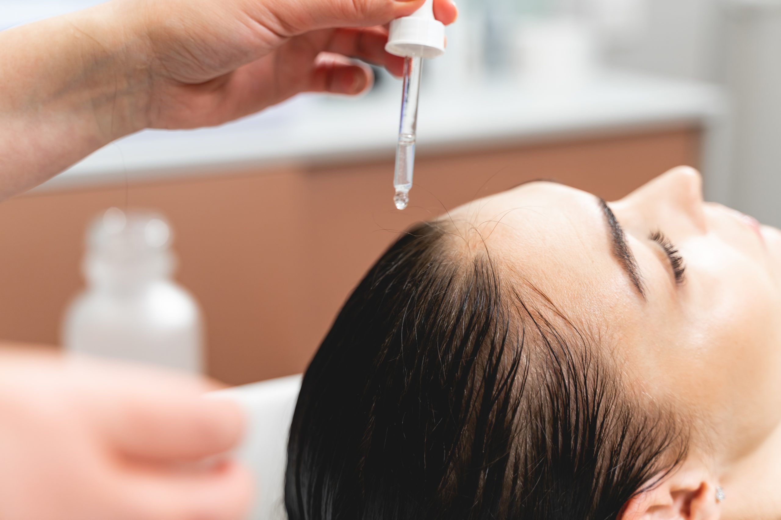scalp treatment